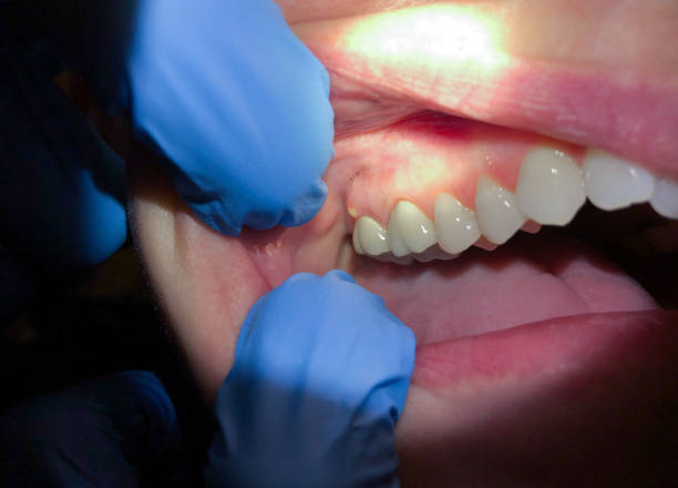 Best Pediatric Emergency Dentist in Lakeside, TX